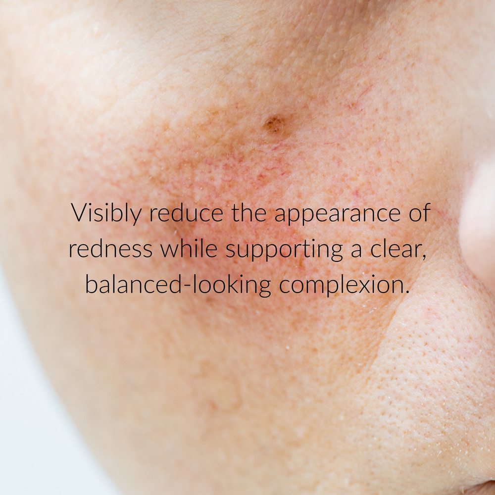 Ruddi 10% Azelaic Acid Redness Calming Cream